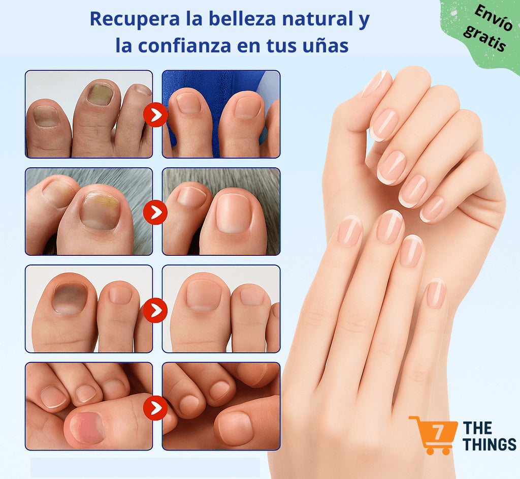 💅✨ Parches Correctores y Nutritivos para Uñas - Confianza y salud en cada aplicación